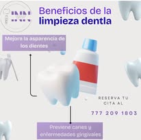 Beneficios de la limpieza dental Innovo Smiles